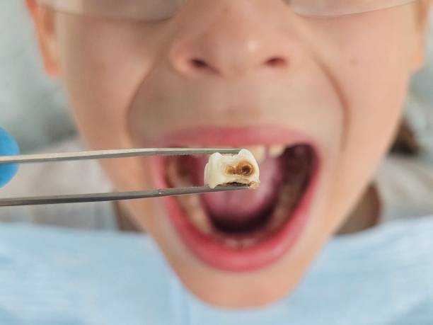 Best Tooth Pain Emergency Relief  in White Knoll, SC