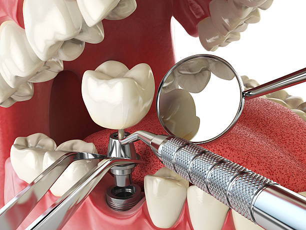 Best Cracked Tooth Emergency Dentist  in White Knoll, SC
